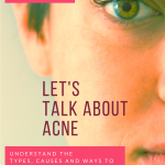 Let’s Talk About Acne